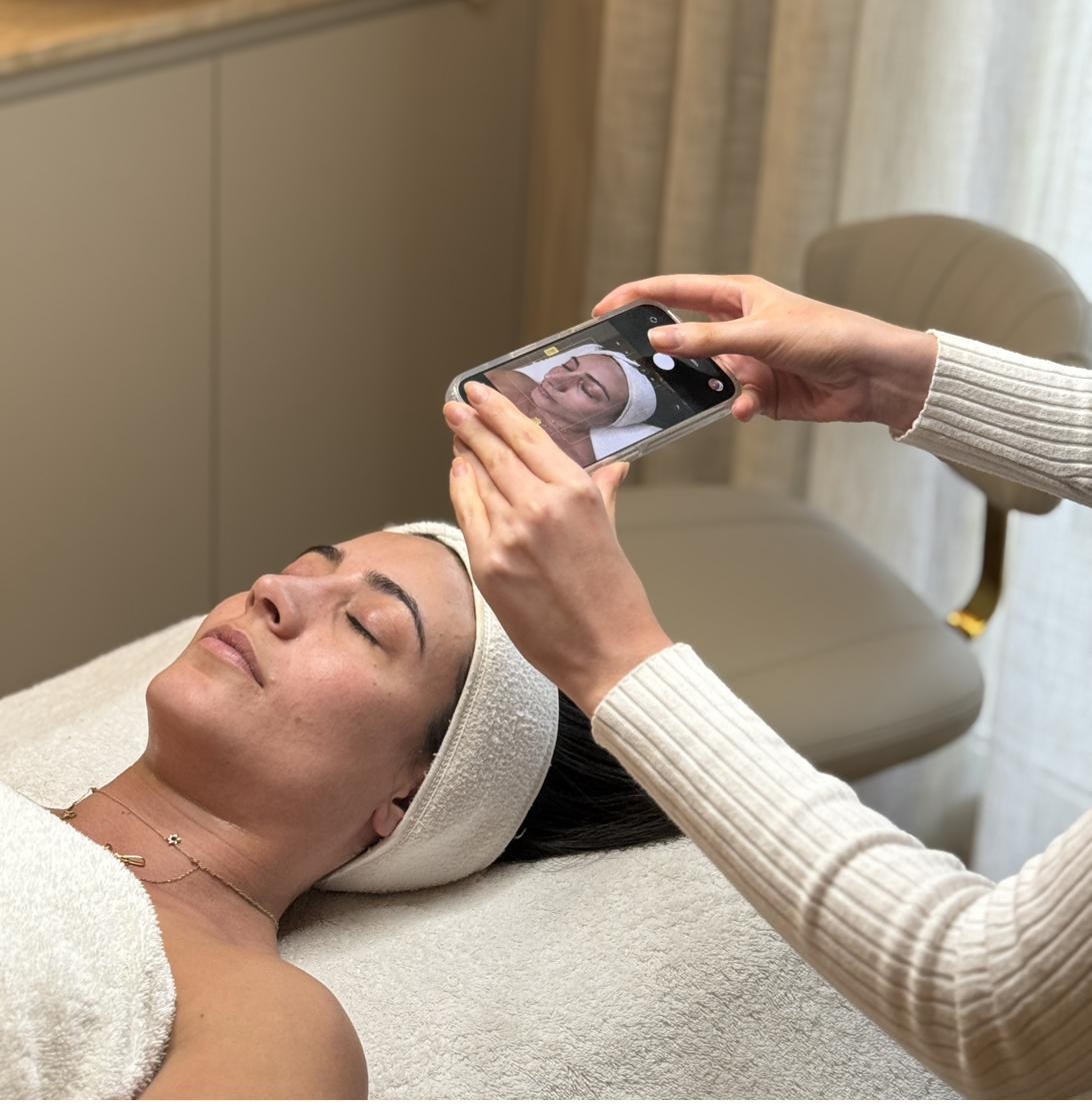 RF microneedling Brisbane — benefits, downtime and results