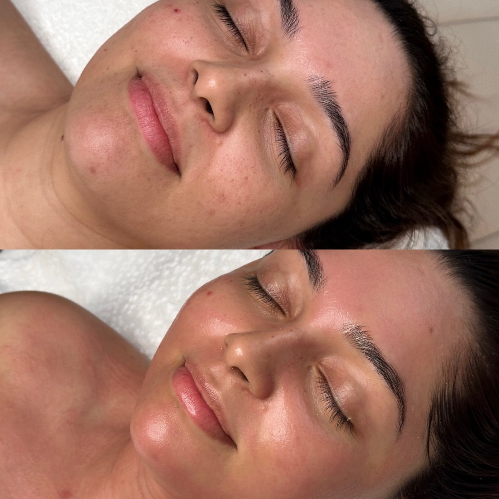 SKYNN clinical philosophy — Brisbane skin clinic