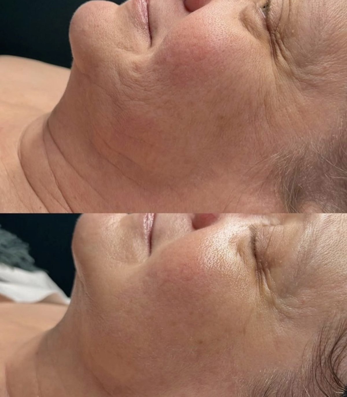 Reviewing skin progress at SKYNN Brisbane