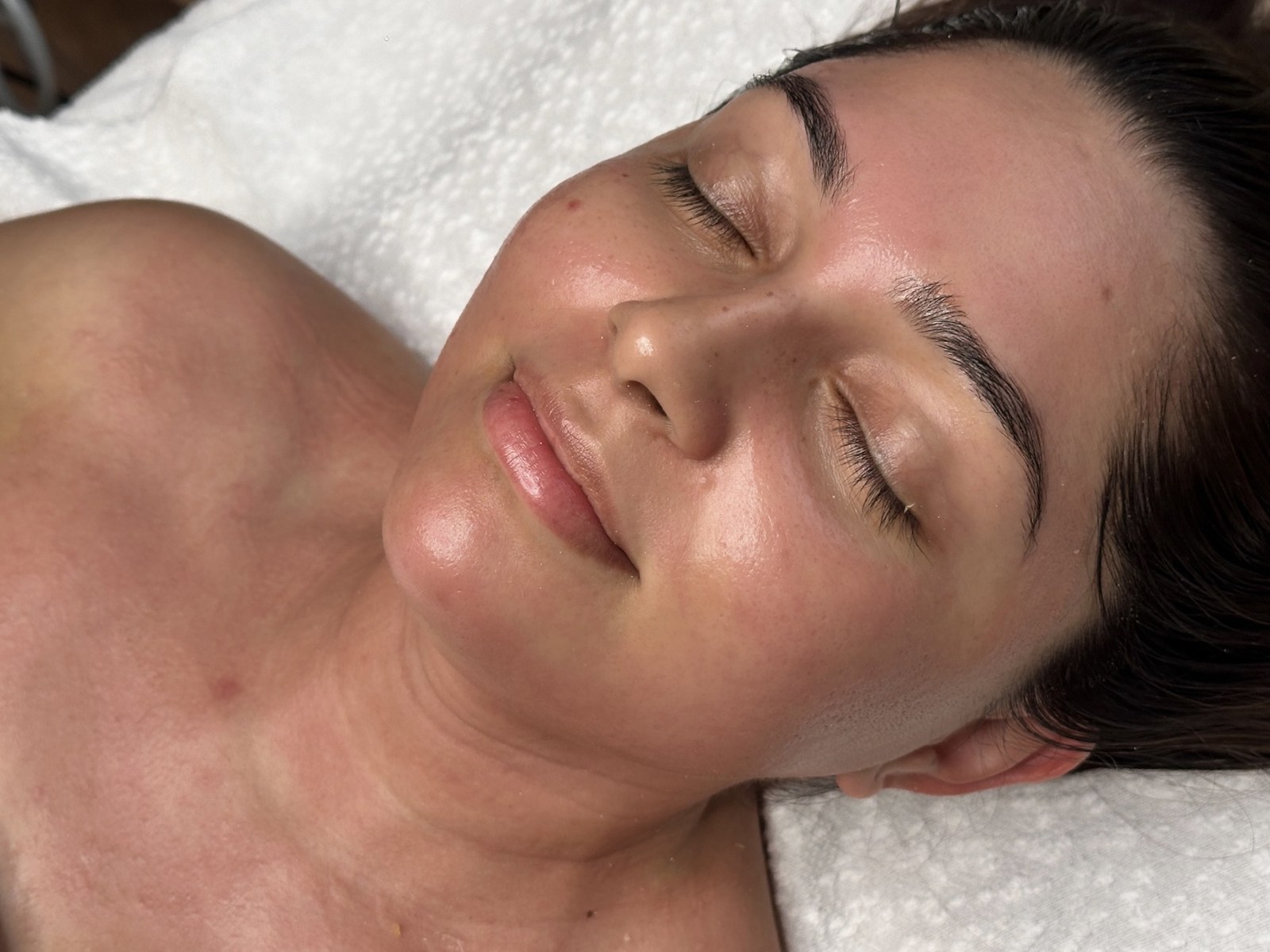 Gua sha lymphatic massage during a restorative clinical recovery session at SKYNN Brisbane